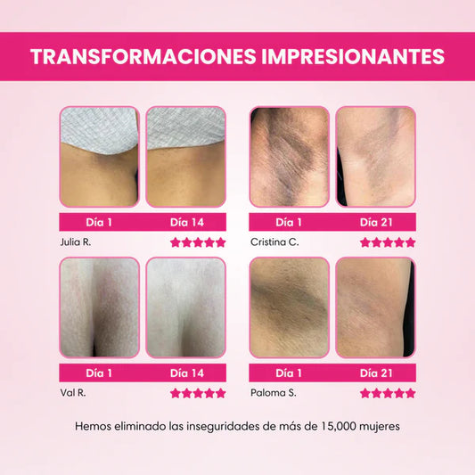 🌸 “Despídete de manchas y tonos oscuros
